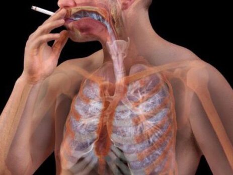 Hút thuốc chủ động hay thụ động đều có thể ung thư vòm họng giai đoạn cuối