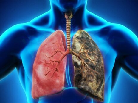 Làm sao để ung thư phổi tránh xa chúng ta?