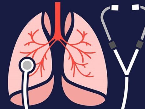 Các câu hỏi về ung thư phổi có mấy giai đoạn