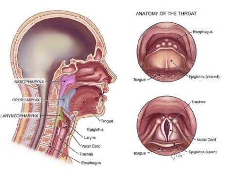 Chẩn đoán ung thư vòm họng qua triệu chứng