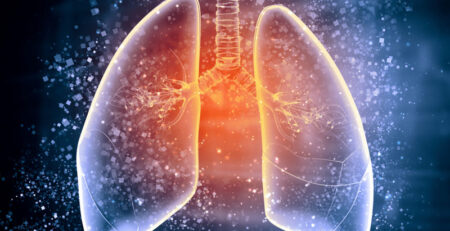 Lao phổi lây thế nào? làm sao để phòng tránh?