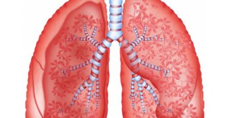 Bệnh bụi phổi - phòng bệnh hơn chữa bệnh