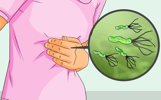 Làm sao biết mình bị nhiễm vi khuẩn hp?