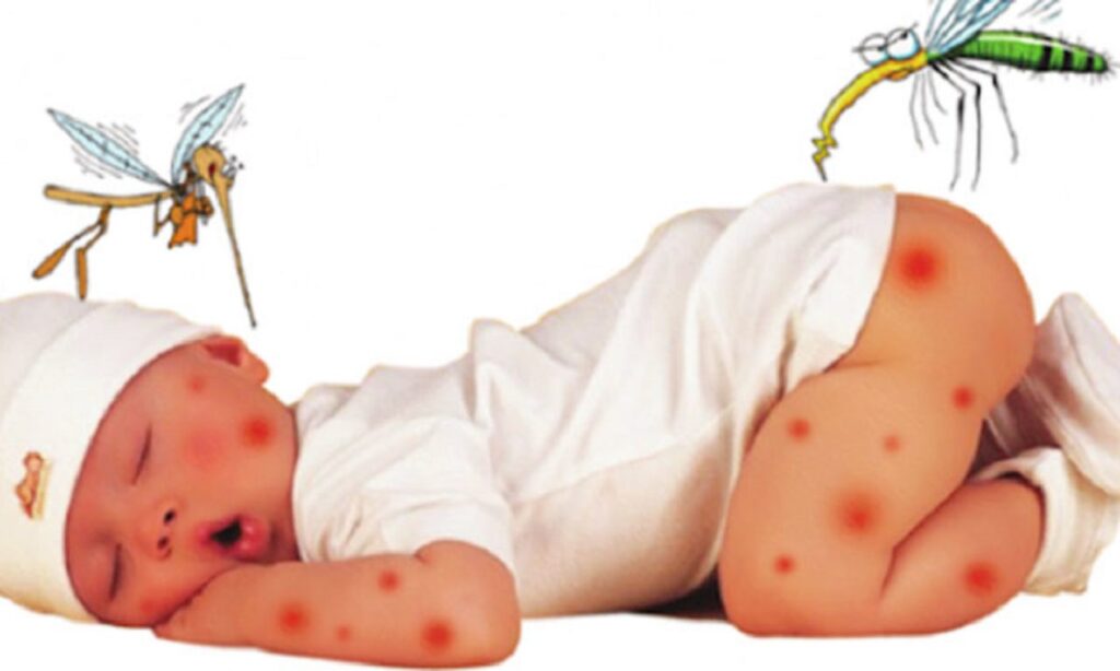 trẻ em thường bị muỗi đốt