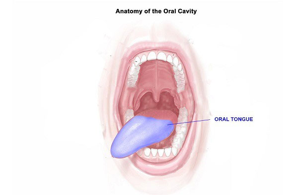 Dấu hiệu của vết loét ung thư lưỡi