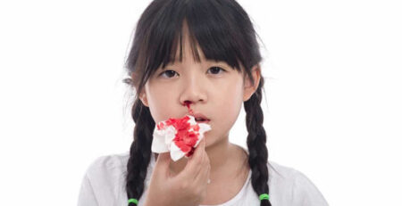 Viêm xoang chảy máu mũi không thể coi thường!